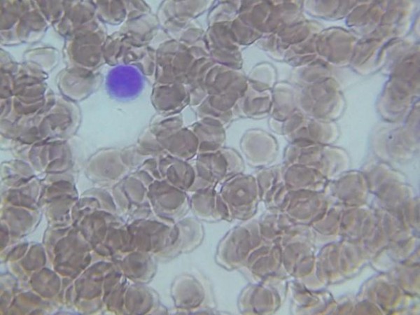 leukocyty-1.jpg